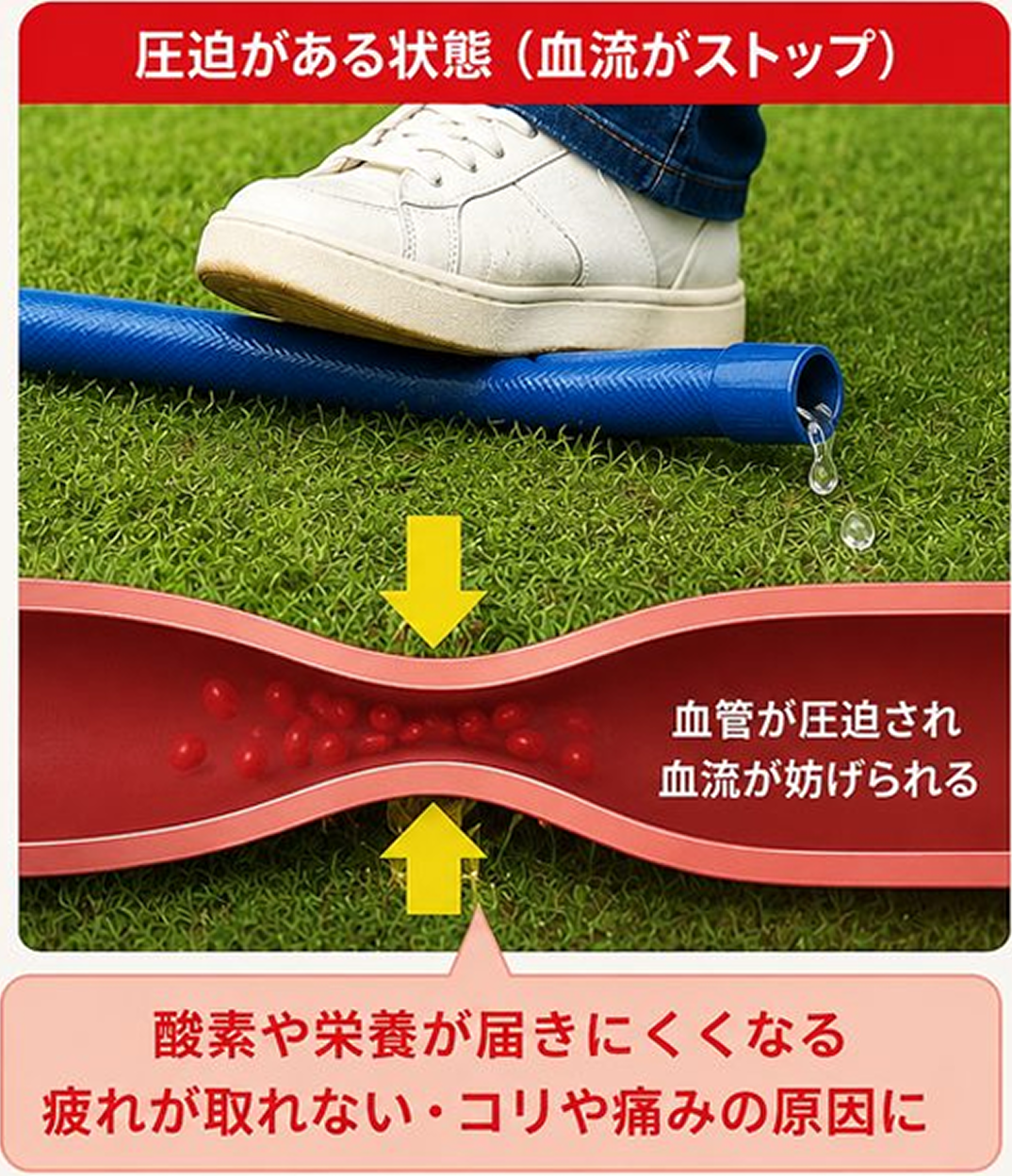 圧迫がある状態（血流がストップ）